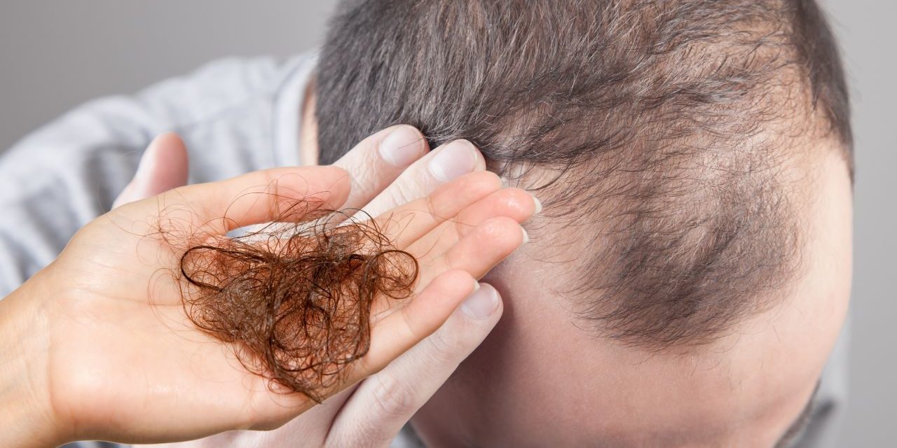Hair Loss Let Us Tell You About Hair Loss Disease And Treatment