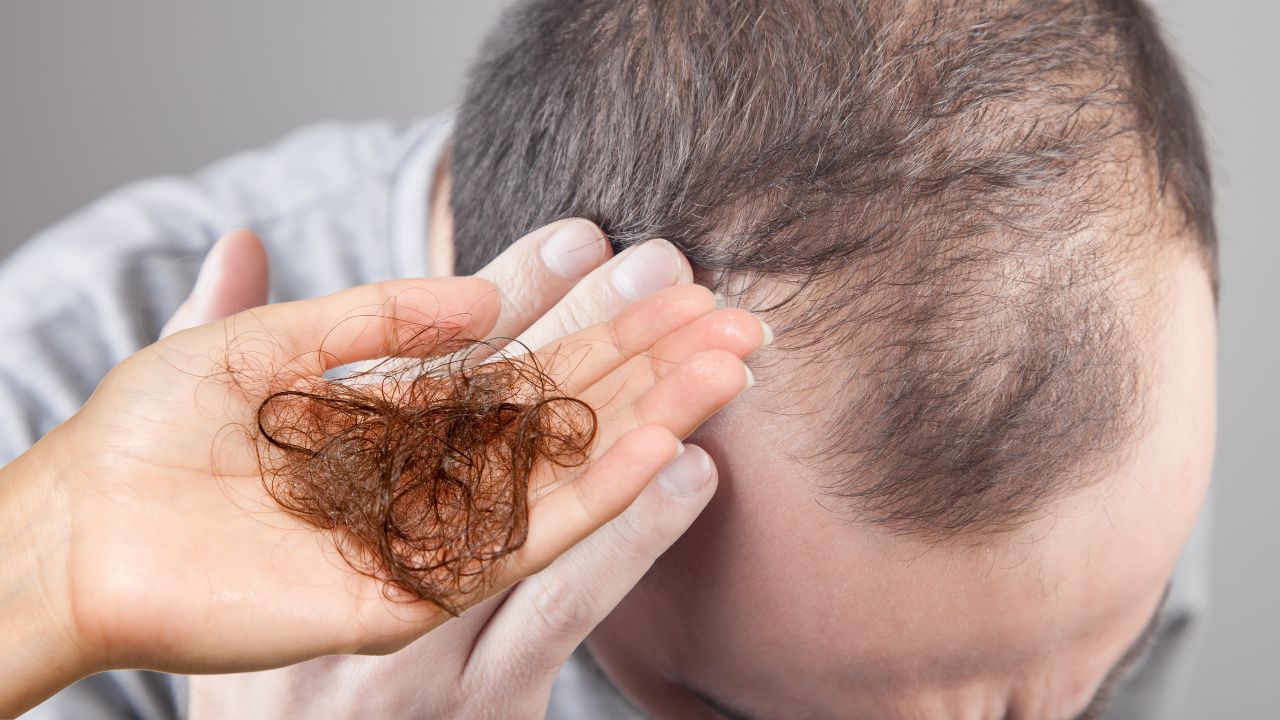 Hair loss treatment: Medicines for hair fall and hair regrowth - Times of  India