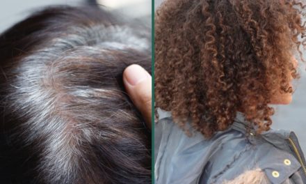 Premature Graying of Hair: Let Us Tell You About Premature Graying of Hair Disease and Treatment