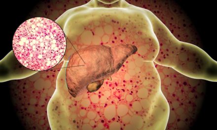 Hepatomegaly: Understanding the Symptoms of Hepatomegaly (Enlarged Liver)