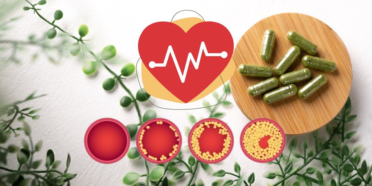 Knowing About High LDL Cholesterol Levels and its Treatment and ...