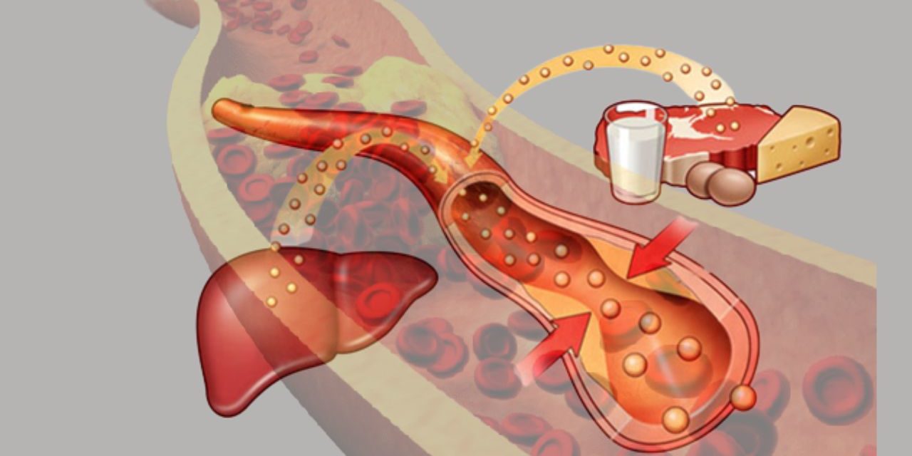 Know About Hyperlipidemia and its Treatment and Prevention HerbTib Blog