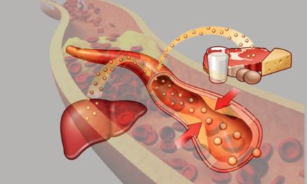 Know About Hyperlipidemia and its Treatment and Prevention