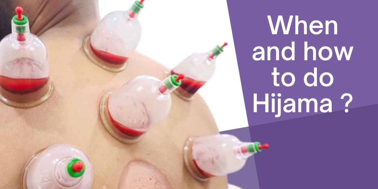 When and How To Do Hijama