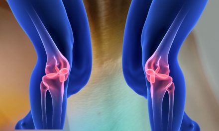 Arthritis: Let Us Tell You About Arthritis Disease and Treatment