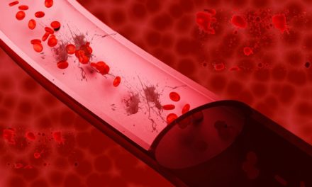Blood Impurities Disease and Best Treatment