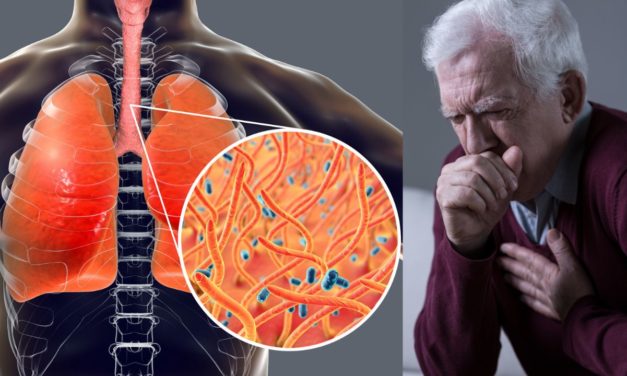 Cough Disease and Best Treatment