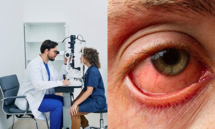 Dispelling the Myth: Is Conjunctivitis (Eye Flu) Spread by Looking?
