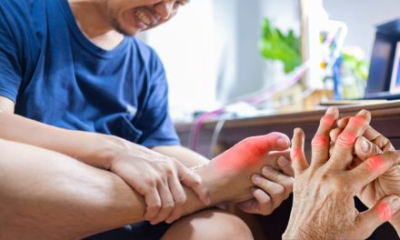 Gout: Let Us Tell You About Gout Disease and Treatment