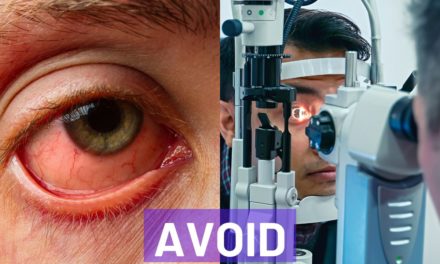What Should We Do to Avoid Conjunctivitis (Eye Flu)?